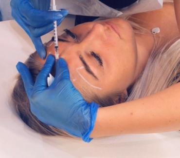 Fine lines and wrinkles are injected into certain areas of the face to help reduce/prevent the appearance of fine lines and wrinkles.  Call us on 07969 509 319 